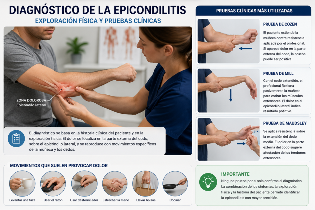 Diagnóstico de la epicondilitis mediante exploración física y pruebas clínicas del codo de tenista.